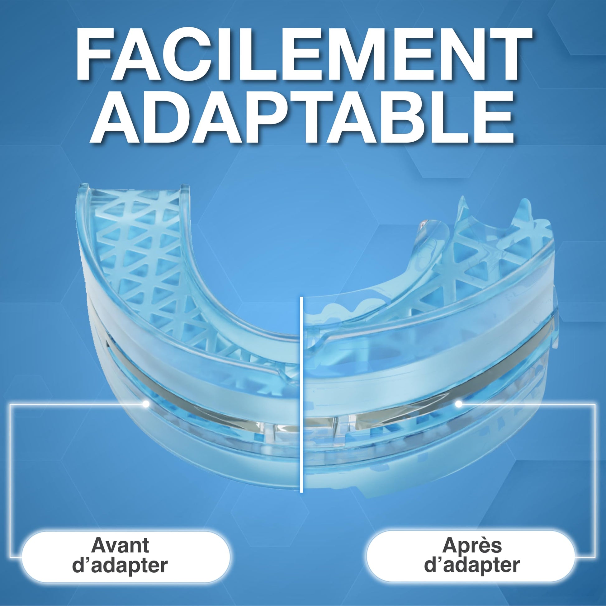 Attelle de ronflement contre le ronflement et le grincement Protège-dents anti-ronflement (attelle de morsure) enfin sans ronflement avec attelle dentaire - réglable comme chez le dentiste - Natural Sleep