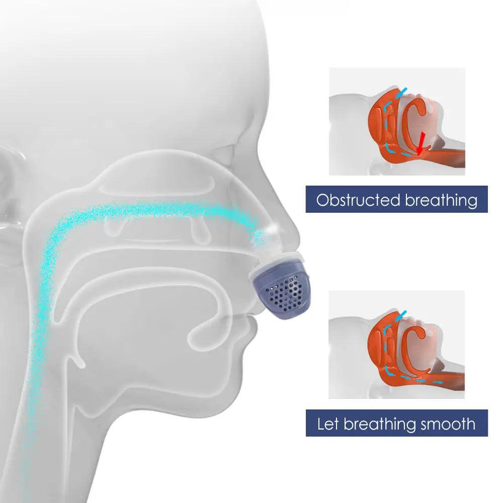 Portable and Rechargeable Anti-Snoring Device for Home Use - Natural Sleep