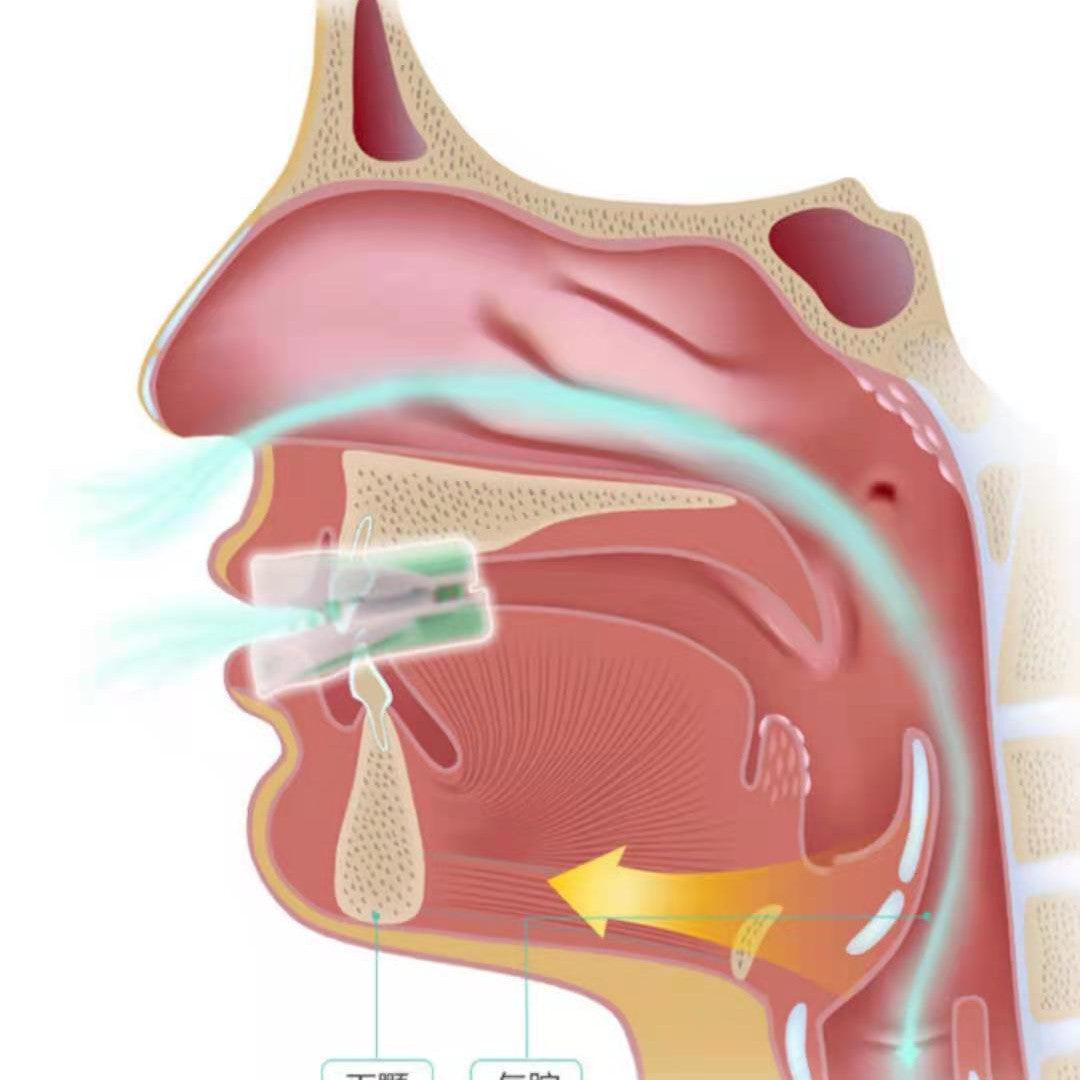 Anti-snoring Braces Anti-snoring Oral Treatment - Natural Sleep