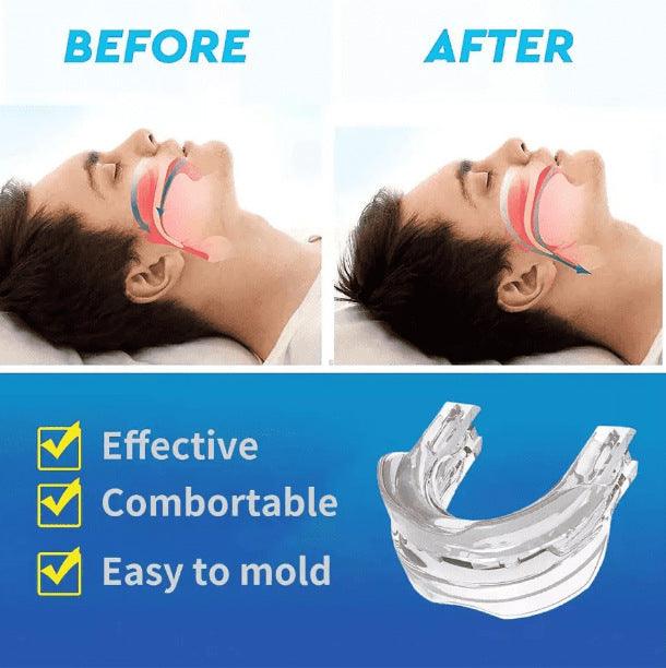 Adjustable Anti-snoring Device Snoring Silicone Tooth Brace - Natural Sleep