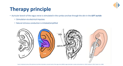 tVNS® E Vagus Nerve Stimulator - Medical Device